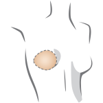 oval
